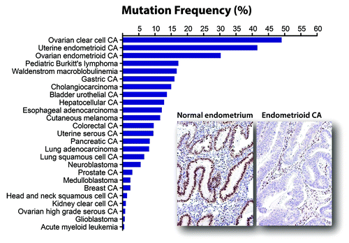 Figure 1. Mutation frequency of ARID1A among human cancers. A total of 594 mutated samples from 5160 tumors belonging to 25 different tumor types have been reported (as of January 2014). Among all neoplastic diseases analyzed, ARID1A mutation is most prevalent in ovarian clear cell carcinoma, uterine endometrioid carcinoma, and ovarian endometrioid carcinoma, all of which are derived from either ectopic or eutopic endometrial epithelium. ARID1A mutations are associated with loss of ARID1A expression as shown in an example of uterine endometrioid carcinoma while normal endometrium expresses ARID1A protein.