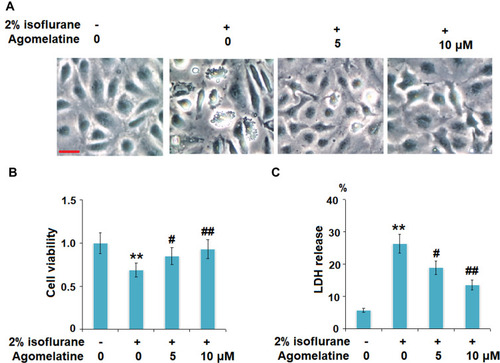 Figure 3 Agomelatine-ameliorated isoflurane-induced reduction of cell viability and release of lactate dehydrogenase (LDH) in bEnd.3 brain endothelial cells. Cells were treated with 2% isoflurane in the presence or absence of agomelatine (5, 10 μM) for 24 h. (A) Morphology of bEnd.3 brain endothelial cells; Scale bar, 100 μm. (B) Cell viability was measured by MTT assay. (C) LDH release was measured by a commercial kit (N=3, **, P<0.01 vs control group; #, ##, P<0.05, 0.01 vs isoflurane group).