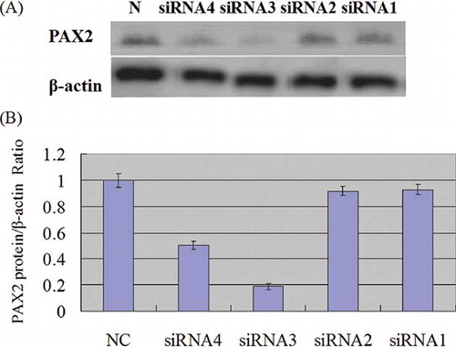Figure 5. Western blotting analysis of PAX2 protein expression. (A) Expression of PAX2 and β-actin proteins in each group transfected by different PAX2-siRNAs; (B) protein of PAX2 in UUO assessed by Western blotting 3 days after PAX2-siRNA-in vivo jetPEI was transfected. The normalized PAX2 protein level of negative control-siRNA-in vivo jetPEI was taken as 1.0.