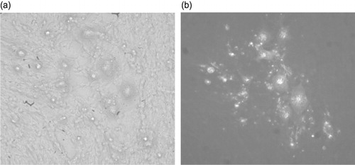 Figure 3. Immunofluoresence and CPE of HVT-infected QM7 foci. QM7 cells were infected with HVT vaccine (MD-Vac; Zoetis, formerly Fort Dodge Animal Health, Fort Dodge, IA, USA) for 7 days in DMEM/F12 with 3% FBS. 3a: CPE of HVT/QM7-infected foci. 3b: Infected cells were then fixed and stained with monoclonal antibody L78. The negative control, QM7, stained completely negative.