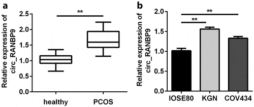 Figure 1. Circ_RANBP9 levels were elevated in patients with polycystic ovary syndrome (PCOS) and in ovarian granulosa cells (GCs). Different levels of circ_RANBP9 were compared in (a) plasma of patients with PCOS (n = 45) and healthy controls (n = 45), as well as (b) normal ovarian epithelium (IOSE80) cells and GCs (KGN, COV434). **P < 0.01