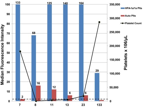 Figure 1 Presence of platelet autoantibodies correlates with development of thrombocytopenia. An IgG antibody reactive with autologous platelets (red bars) was detected in PTP patient serum collected on Days 7, 8, 11, 13, 23 post-surgery when patient had thrombocytopenia (black line). Serum collected Day 133 post-surgery following platelet count recovery showed no autoantibodies. Strong IgG antibodies against HPA-1a/1a normal donor platelets (blue bars) were detected in sera from each time point. Values shown are flow cytometry median fluorescence intensity (MFI). Dashed line is MFI cut-off for antibody positive results.