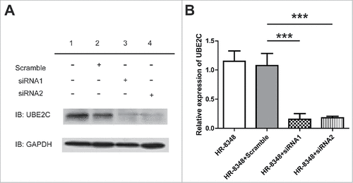 Figure 2. siRNA of UBE2C down-regulated the expression level of UBE2C in HR-8348 cells. A) Western blot showed the protein level of UBE2C after the treatment of siRNA. B) Q-PCR showed the expression level of UBE2C in the cells with different treatments as indicated. ### indicated p<0.001.