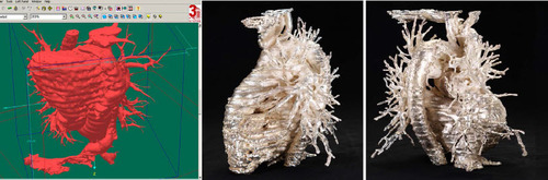 Figure 1. Silver Heart: MRI and the sculpture from two angles, Jane Prophet, 2004. Photo Jane Prophet, courtesy of the authors