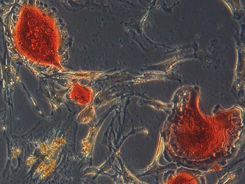 Figure 2. (×300): TRAP staining and identify was performed about six days after culture. TRAP staining showed that the cytoplasm of polykaryocytes was rose pink, which was demonstrated to be mature osteoclasts.