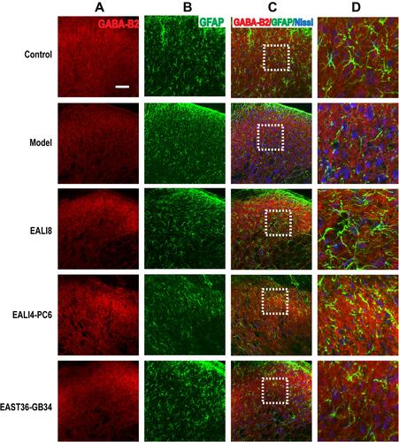 Figure 10 No co-expression of GABA-B2, Iba-1, and Nissl was found. Representative confocal images of C4-C5 spinal cord sections showing no coexpression of GABA-B2 (red) and Iba-1 (green) and Nissl (blue) in the superficial laminae of C4-C5 DHs at 24h after modeling in rats. Results showed no expression of GABA-B1 in microglia. (A) GABA-B1, (B) Iba-1, (C) merge, (D) magnification of the dashed squares from their left merged images. The bar on the top-left image represents 50µm.