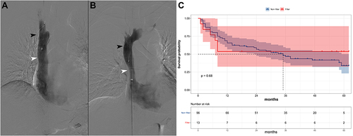 Figure 1 (A) Intraoperative cavography after placement of an Aegisy vena cava filter placement. Black arrowhead, filter; white arrowhead, superior vena cava. (B) Intraoperative cavography after placement of a Celect vena cava filter. Black arrowhead, filter; white arrowhead, superior vena cava. (C) There was no difference in mortality between groups with and without vena cava filters.