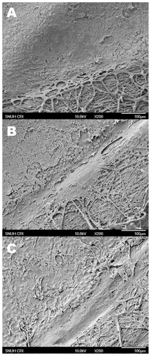 Figure 3 Scanning electron microscopic photographs of human corneal endothelium after 1 A) 2 B) and 3 C) freezing–thawing (F/T) cycles. A smooth surface of normal-appearing endothelial cells was observed adjacent to the bare cornea treated with one F/T cycle A) Corneal endothelial cell damage was more remarkable after 2 B) or 3 cycles of F/T. Descemet’s membrane was stripped off where the cryoprobe was applied transcorneally, and the posterior stromal surface was exposed in all groups (right lower parts in A, B, and C) Original magnification X200.