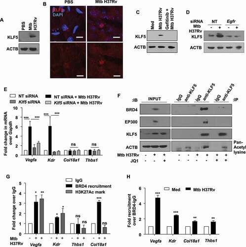 Figure 7. Mtb-dependent KLF5 assists BRD4-mediated regulation of angiogenic markers. (A and B) KLF5 protein expression was assessed (A) in the lung homogenates of 44 d-Mtb H37Rv-infected mice by immunoblotting and (B) in the lung cryosections of infected mice by immunofluorescence imaging (n = 3 mice in each group). (C) Murine peritoneal macrophages were pre-treated with EGFR inhibitor gefitinib for 1 h, followed by 12 h infection with Mtb H37Rv; and whole cell lysates were assessed for the expression of KLF5 by immunoblotting. (D) Mouse peritoneal macrophages were transfected with NT or Egfr siRNA and infected with Mtb H37Rv for 12 h. Whole cell lysates were assessed for KLF5 expression by immunoblotting. (E) Murine peritoneal macrophages were transfected with Klf5 siRNA or NT siRNA for 24 h. Transfected cells were infected with Mtb H37Rv for 12 h and assessed for the expression of the indicated angiogenic genes. (F) Murine peritoneal macrophages were infected with Mtb H37Rv for 12 h and assessed for the interaction of BRD4, EP300 and KLF5 and KLF5 acetylation by immunoprecipitation assay. (G) The recruitment of BRD4 and corresponding H3K27Ac marks were analyzed on the promoters of the indicated genes (at KLF5 binding regions) by ChIP. (H) Sequential ChIP was performed to access the co-occupancy of the indicated promoters by KLF5 and BRD4 in uninfected and Mtb H37Rv-infected peritoneal macrophages. All qRT-PCR data represents mean±S.E.M. and immunoblotting data is representative of three independent experiments. Med, medium; *, p < 0.05; **, p < 0.005; *** p < 0.001 (Students t-test in H and one-way ANOVA in E, G; GraphPad Prism 5.0); ns, not significant; scale bar: 5 μm. ACTB was utilized as loading control.