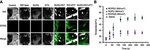 Figure 6 (A) The confocal images of SOSG-stained sections at 6 hrs after various treatments. Scale bars represent 100 μm. (B) Temperature change curves in tumors exposed to the 808 nm laser at a power density of 0.3 W/cm2 and 1.6 W/cm2 after intravenous injections of saline, RCP, and RCPD.Abbreviations: SOSG, singlet oxygen sensor green.