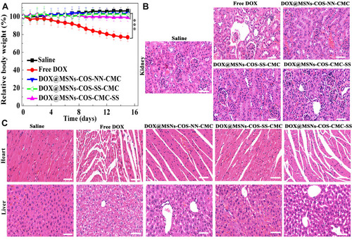 Figure 9 Biosafety analysis of DOX-loaded nanoparticles in HeLa tumor-bearing mice. (A) Changes of body weight. Data are presented as the mean value ±standard deviation (n=3). ***Means P <0.001, compared with the control group. (B and C) H&E staining analysis of kidney, heart and liver (Scale bar, 50 μm).Abbreviations: MSNs, mesoporous silica nanoparticles; DOX, doxorubicin hydrochloride; COS, chitosan oligosaccharide; COS-SS, disulfide-containing chitosan oligosaccharide; COS-NN, non-cleavable chitosan, diallyl disulfide was replaced by N,N′-methylenebisacrylamide; CMC, carboxymethyl chitosan; CMC-SS, disulfide-containing carboxymethyl chitosan.