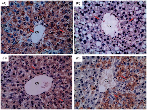 Figure 7. A photomicrograph of liver section obtained from different groups (eNOS immunohistochemical stain; 400×), where (A) normal control group showing strong immunoreactivity to eNOS which appears as brown colour (red arrow); (B) ferrous sulphate group showing weak to negative immunoreactivity to eNOS which appears as brown colour (red arrow); (C) N-acetylcysteine plus ferrous sulphate group showing strong immunoreactivity to eNOS which appears as brown colour (red arrow) but not as normal control group; (D) saponin plus ferrous sulphate group showing moderate immunoreactivity to eNOS which appears as brown colour (red arrow).