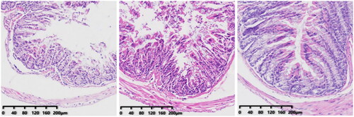 Figure 12. Renal pathology after FMT intervention (from left to right, CS, CSF, FS).