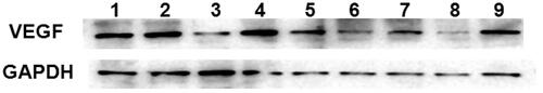 Figure 7. VEGF protein determined at 48 h by Western Blot after treatment with free siRNA, free Sf, CMCS-Sf-CL, CMCS-Si-CL, SiSf-CL, CMCS-SiSf-CL (pH 7.4), CMCS-SiSf-CL (pH 6.5), and CMCS-NCsi-CL in HepG2 cells. Non-treated cells serve as control.