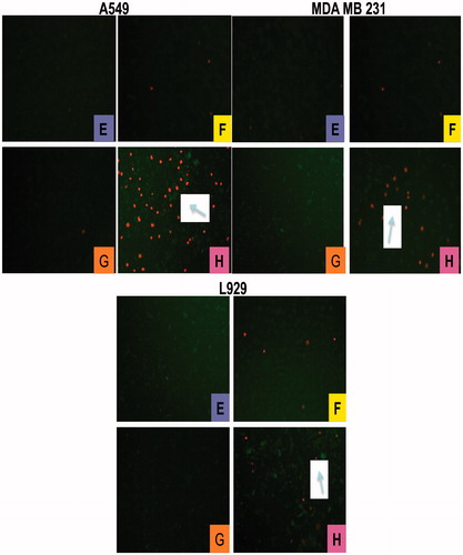 Figure 7. Necrotic cell images obtained from the double-staining method using PI fluorescent stain. (E) A549, MDA MB 231 and L929 cells stained by double-staining method. Each cells not treated with ASO and PHB-PEG NPs (control group). Cells did not necrose. Green spots shows nucleus of non-necrotic cells (stained by Hoechst 33342); (F) Cells exposed to free ASO at a concentration of 200 μg/ml; (G) Cells exposed to the PHB-PEG NPs at a concentration of 200 μg/ml; (H) Photograph of all cells transfected with ASO-adsorbed PHB-PEG NPs. The arrow shows some of the necrotic cells where dense red spots. Photographs were taken under FITC filter by using Leica inverted fluorescent microscope at 400 × magnification. The scale shows a distance of 70.5 μm.