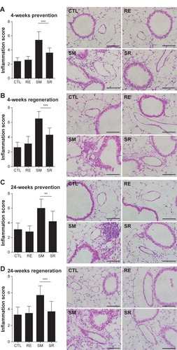 Figure 3 Degree of inflammatory cell infiltration.