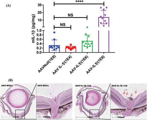 Figure 5. Even an ultralow dose of AAV–IL-1β (1E6) induces cellular infiltrates in the vitreous. (A) Mice were injected IVT with 1E4, 1E6, or 1E8 vg/eye of AAV–IL-1β, and 5 weeks later whole eye lysates were used in ELISA to detect the amount of IL-1β in the eye. Each symbol represents an eye sample. (B) H&E staining of the whole eye showing no cellular infiltrates in the AAV-null-injected eye and the presence of cellular infiltrates (red arrows) in 1E6 AAV–IL-1β-injected eye. Histology pictures are representatives of 4 eyes per experimental group.