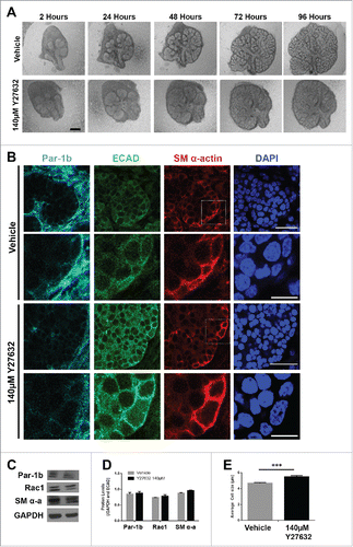 FIGURE 6. ROCK is Required for the Morphogenesis but Not the Differentiation of the Myoepithelial Cells in the Developing Mouse SMG (A) Representative brightfield images of E13 SMG explants cultured for 96 hours with vehicle control media or with 140µM Y27632 to inactivate ROCK. Scale bar, 100µm. (B) ICC was performed on E13 explants grown in culture for 96 hours and treated with vehicle or with 140µM Y27632 ECAD (green), Par-1b (cyan), and SM α-actin (red) with DAPI staining (blue). Y27632-treated glands show a mislocalization of Par-1b throughout the cytoplasm of ECAD+ cells rather than a basolateral restriction in these cells. Additionally, SM α-actin+ cells appeared to be less compressed with Y27632 treatment. Scale bars, 10µm top panels, 2µm bottom panels. Lower panels are zooms from boxed areas in top panels (C and D) Representative western analysis and quantification (n ≥ 3) following 96-hour culture +/− 140µM Y27632 treatment shows no significant change in the levels of Par-1b, Rac1, or SM α-actin. (E) The height (µm) of individual epithelial cells expressing SM α-actin (n ≥100 ) was measured in glands treated +/− 140µM Y27632 for 96 hours. Height of the ECAD+/SM α-actin+ cells in the glands treated with Y27632 was significantly larger than in the vehicle control-treated glands (*** p ≤ 0.001)