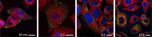 Figure 3 Confocal microscopy images of intracellular delivery of MTX-DG liposomes in A549 cells in relation to endoplasmic reticulum.Notes: The liposome membrane is labeled with BODIPY-MTX-DG (green); endoplasmic reticulum, with the ER-Tracker (red); cell nuclei are stained with Hoechst (blue). Prior to the experiment, the cells were cooled to 4°C and incubated with liposomes (9% MTX-DG and 1% BODIPY-MTX-DG by mol, 100 μM total lipid) for 60 minutes on ice, washed, and then incubated for various time periods at 37°C in a complete medium. The scale bar is 10 μm.Abbreviations: BODIPY-MTX-DG, fluorescently labeled analog of MTX-DG; ER, endoplasmic reticulum; MTX, methotrexate; MTX-DG, lipophilic prodrug of methotrexate.