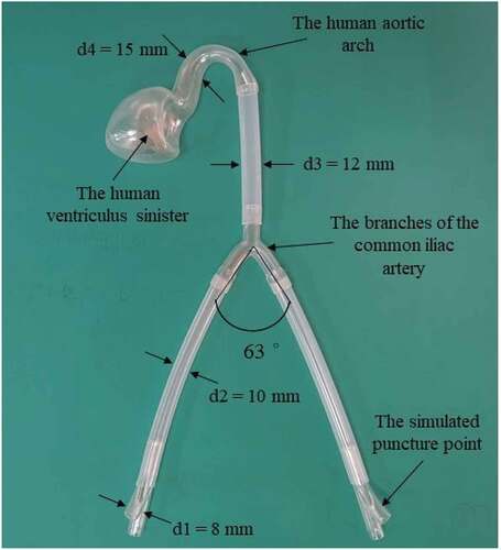 Figure 11. The human aortic vascular model.