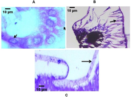 Figure 3. Histopathological micrographs of phyllosoma of Thenus unimaculatus demonstrating (black arrow) internal bacterial proliferation. Transverse section of (A) lumen of the hepatopancreas tubules (B) eye region (C) appendages.