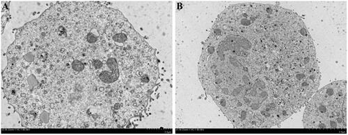 Figure 5. TEM images of K1 cells incubated with FTY720@SF-Se NPs (A) and FTY720@T7-SF-Se NPs (B) after 8 h.