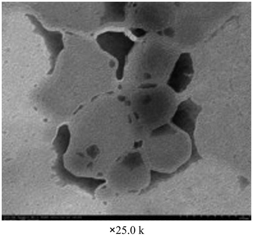 Figure 9. TEM image of blank liposomal dry powders.