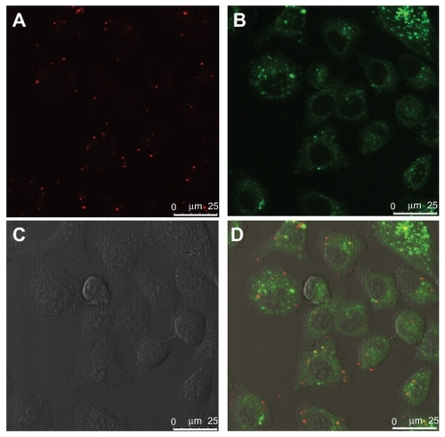 Figure 5 Colocalization of polycation lipid nanocarrier/DNA complexes (PDC) (N/P = 10) with late endosomes/lysosomes in human lung adenocarcinoma (SPC-A1) cells under laser scanning confocal microscopy at 2 hours after transfection. (A) TM-Rhodamine labeled plasmid DNA (red); (B) LysoTracker Green DND26 labeled late endosomes/lysosomes (green); (C) phase-contrast image of S PC-A1 cells; (D) merged image, scale bar = 25 μm.Figure 6 Colocalization of polycation lipid nanocarrier/DNA complexes (PDC) (N/P = 10) with nucleus in human lung adenocarcinoma (SPC-A1) cells under laser scanning confocal microscopy at 6 hours after transfection. (A) TM-Rhodamine labeled plasmid DNA (red); (B) Hoechst 33258 labeled nuclei (blue); (C) phase-contrast image of SPC-A1 cells; (D) merged image, scale bar = 25 μm.Display full size