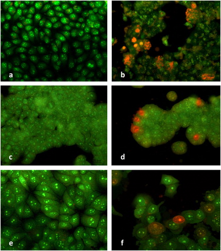 Figure 3. Fluorescence microscopy of human tumour cells after 24 h treatment with metamizole. HeLa control (a); HeLa metamizole 400 µg/mL (b); HT-29 control (c); HT-29 metamizole 300 µg/mL (d); MCF-7 control (e); MCF-7 metamizole 400 µg/mL (f). Magnification 40Х; AO/EtBr staining.
