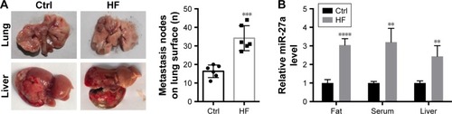 Figure 4 Obesity promoted HCC metastasis in vivo with upregulation of miR-27a.