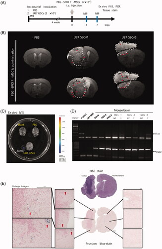 Figure 6. In vivo validation of MRI for trafficking PEG–SPIO-labelled P-MSCs infiltration into mouse brain tumors. (A) Flowchart of experimental procedure. (B) T2 MRI of representative sham (PBS) and glioma-bearing (U87 GSC) mice on day 4 and day 7 after PEG–SPIO-labelled P-MSC injection. Significant hypointense spots (red arrowhead) developed at the tumor’s edge (white dashed line) or within the tumor area with the time in glioma-bearing mouse. (C) Ex vivo of BLI on mouse brains collected from normal (blank), sham (PBS) and glioma-bearing (U87 GSC) mice shows bioluminescence signals in the excised brain tumor of U87 GSC mouse #5. (D) PCR of luciferase gene in the genomic DNA isolated from individual mouse brain after 7 days of P-MSCs administration. Mouse CISD2 gene was used as the DNA loading control. (E) Prussian blue and H&E staining of entire brain sections harvested from U87 GSC-bearing mice. Red arrow indicates iron signal of P-MSCs.