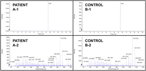 Figure 3. Toxicology data from analytically confirmed bongkrekic acid ingestion. Panel A represents the data from the patient sample and panel B represents the data from a spiked control containing 2,000 ng/mL of bongkrekic acid. The top panes (-1) are extracted ion chromatograms and the bottom panes (-2) are high-resolution MS/MS fragmentation spectra, showing the data from the patient sample and the control are consistent.