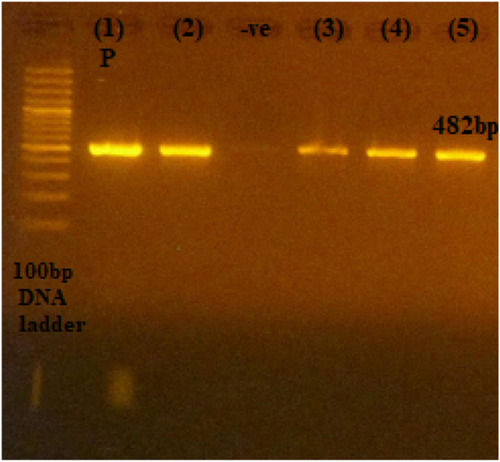 Figure 3 The 482-bp PCR amplification of aac(6ʹ)-lb gene among P. aeruginosa isolates. First lane, DNA ladder, 100-bp DNA size marker; (1) P, positive control; (2), (3), (4), and (5), clinical isolates; −ve, negative control.