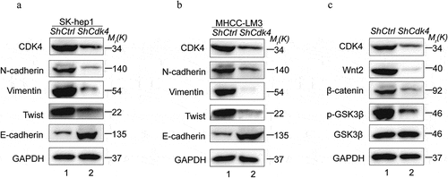 Figure 6. CDK4 regulates EMT markers and Wnt/β-catenin signaling pathway in HCC. (a) Western Blot analysis showed reduced N-cadherin, Vimentin, Twist and increased E-cadherin expression in Sh-CDK4 Sk-hep1 cells compared with normal controls. (b) Western Blot analysis showed reduced N-cadherin, Vimentin, Twist and increased E-cadherin expression in Sh-CDK4 MHCC-LM3 cells compared with normal controls. (c) Western Blot analysis showed reduced Wnt2, β-catenin, p-GSK3βexpression in Sh-CDK4 Sk-hep1 cells compared with normal controls, whereas the expression of GSK3βdidn’t change significantly