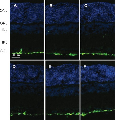 Figure 2 Immunohistochemistry staining of GFAP expressed in retinas at 2 weeks after intravitreal injection.Notes: (A) Low group: intravitreal injection of 2.5 mg/0.1 mL PLGA/PLA microspheres; (B) medium group: intravitreal injection of 5 mg/0.1 mL PLGA/PLA microspheres; (C) high group: intravitreal injection of 10 mg/0.1 mL PLGA/PLA microspheres; (D) EPO group: intravitreal injection of 5 mg/0.1 mL EPO–dextran PLGA/PLA microspheres; (E) PBS group: intravitreal injection of 0.1 mL 0.01 M PBS; (F) normal group: normal retinas received no intravitreal injection. GFAP expression was mainly localized in the inner limiting membrane in all groups without any differences between groups.Abbreviations: EPO, erythropoietin; GCL, ganglion cell layer; GFAP, glial fibrillary acidic protein; INL, inner nuclear layer; IPL, inner plexiform layer; ONL, outer nuclear layer; OPL, outer plexiform layer; PBS, phosphate-buffered saline; PLGA/PLA, poly(lactic-co-glycolic acid)/poly(lactic-acid).