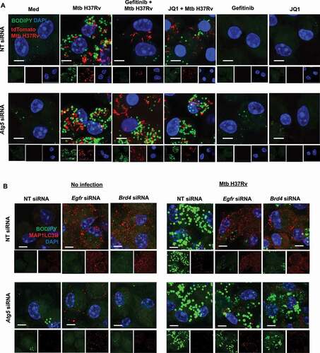 Figure 4. Inhibition of EGFR-BRD4 induces lipophagy. (A) Murine peritoneal macrophages were transfected with NT or Atg5 siRNA. The transfected cells were infected for 48 h with tdTomato Mtb H37Rv followed by 12 h treatment with gefitinib or JQ1 and assessed for lipophagy by staining for LDs with BODIPY 493/503. (B) Mouse peritoneal macrophages were transfected with NT, Egfr or Brd4 siRNAs in the presence or absence of Atg5 siRNA. Transfected cells were infected with Mtb H37Rv for 60 h and assessed for lipid droplet accumulation (BODIPY 493/503) and autophagy (MAP1LC3B) by immunofluorescence. Med, Medium; NT, non-targeting; Scale bar: 5 μm.