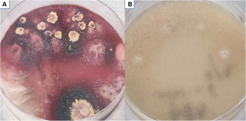 Figure 5 Microbiological examination-colony morphology (A and B). (A) T. marneffei presented in the mycelial phase, with the presence of broom branches and production of red pigment at 25°C. (B) Yeast phase at 37°C.