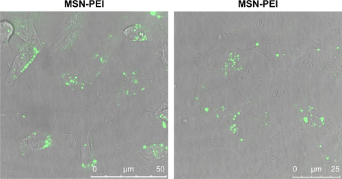 Figure S2 Comparison of cellular internalization of MSN and MSN-PEI nanoparticles.Abbreviations: MSN, mesoporous silica nanoparticle; PEI, poly(ethyleneimine).