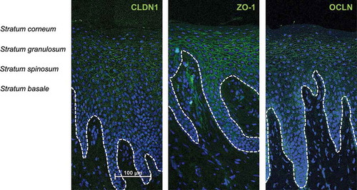 Figure 4. Expression and localization of CLDN1, ZO-1 and OCLN in healthy human gingiva.