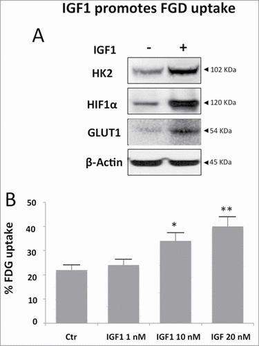 Figure 6. IGF1 increases FGD uptake in Calu-1 cells. Calu-1 cells were treated by IGF1 for 24 hours. (A) Western blot analysis of Calu-1 total cell lysates probed with specific antibodies for HK2, HIF1α and GLUT1 and β-Actin. (B) Cell uptake of FDG was expressed as percentage of total tracer availability according to different IGF1 concentrations. p values are shown for each comparison: * P < 0.05; ** P < 0.01.