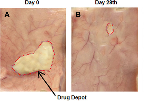 Figure 5 Biodegradation studies (A) showing changes at the site of injection and depot formation at day 0; (B) reduction in the size of depot after 28 days.