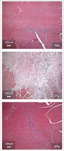 Figure 2. Microphotographs showing the injection site after intramuscular injection of either phosphate-buffered saline, Ply (10 µg) or dPly (10 µg) in rat tibialis.