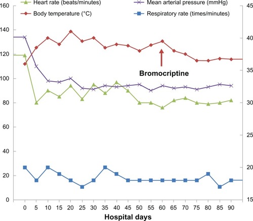 Figure 2 High fever with marked temperature fluctuation was noted during the clinical course.