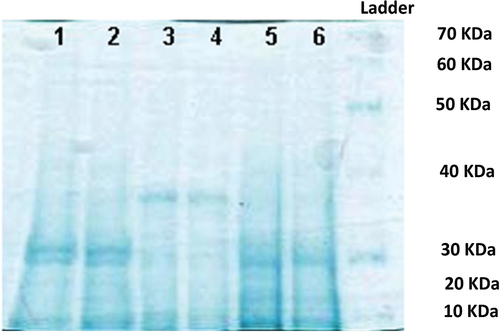Figure 6. 10% SDS-PAGE gel of soluble proteins of Dunaliella salina (1 and 2: 9000 μg l‒1, 3 and 4: 6000 μg l‒1, 5 and 6: 3000 μg l‒1 of anthracene).