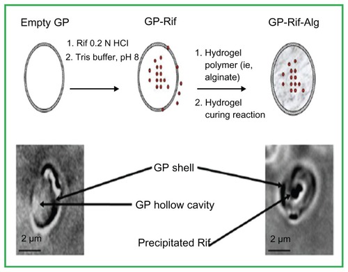 Figure 5 Top: Schematic representation of rifampin (Rif) (red circles) loaded into glucan particles (GPs) and sealed with a hydrogel. Bottom: bright-field microscope images of an empty GP (left) and a GP-Rif sample (right).Reproduced from Soto E, Kim YS, Lee J, Kornfeld H, Ostroff G. Glucan particle encapsulated rifampicin for targeted delivery to macrophages. Polymers. 2010; 2(4):681–689.Citation44