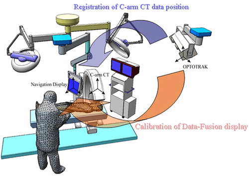 Figure 4. Configuration of the navigation system and coordinate transformation. [Color version available online.]