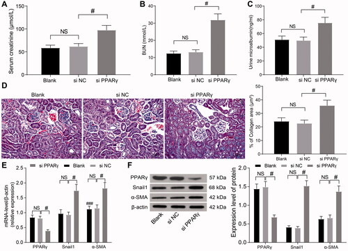 Figure 3. PPARγ-mediated inhibition of β-catenin signaling alleviates HN. (A–C) SCr (A), BUN (B), and mALB (C) contents were determined by biochemical analysis. (D) Images and quantification of Masson's staining. (E,F) Levels of PPARγ and β-catenin target genes were examined by RT-qPCR (E) and WB (F). #p < 0.05 vs. si-NC group. NS means not significant. Results of each group were measured data expressed as mean ± SD. One-way or two-way AVONA was used for comparison among groups. N = 5.