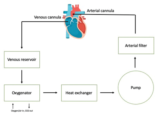 Figure 1. Schematic diagram of a CPB system.