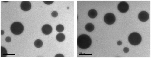 Figure 3. Transmission electron micrographs of Cu B-PL/SDC-MMs. The images of the initial MMs solution and reconstituted MMs solution are represented on the left and right side, respectively (scale bar = 100 nm).
