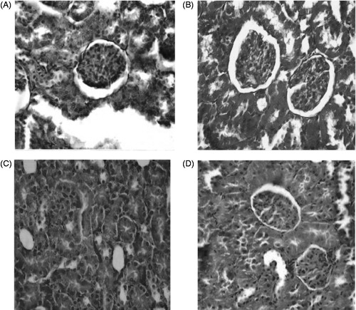 Figure 1. Micrographs of rat kidney tissues: (A) Saline group, normal morphology; (B) ZE group, similar structure as saline group with normal tubules and glomeruli; (C) IBP-treated group, hypercellularity in some and shrinkage in other glomeruli lines, ischemia in proximal convoluted tubules and congestion and (D) ZE + IBP-treated group, normal morphology of tubules and glomeruli as saline group.